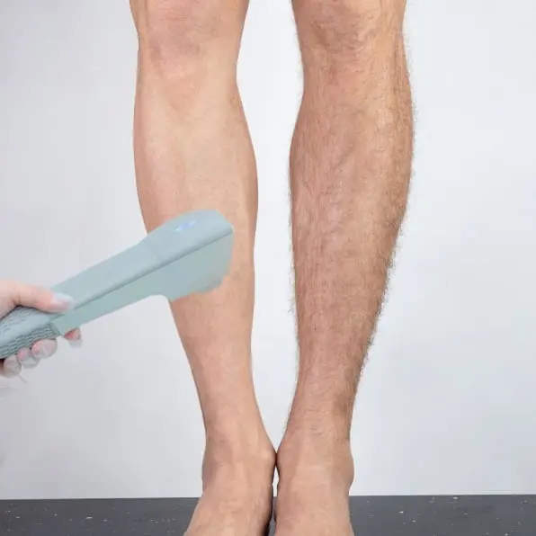 Depilação a laser Pernas Contagem