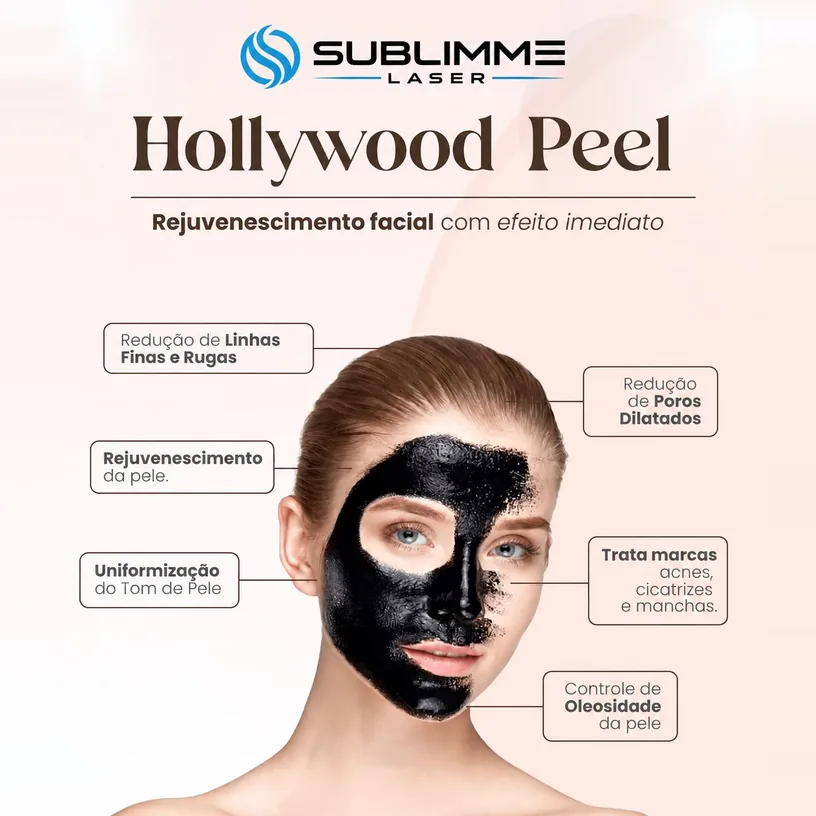 Peeling de Hollywood